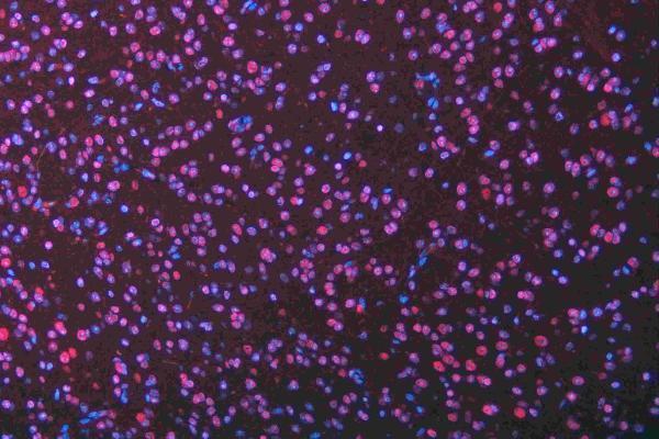 a05052 1 msi1 primary antibodies if testing 23