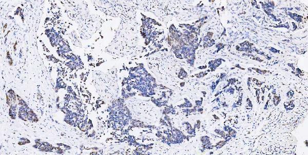 a05052 1 msi1 primary antibodies ihc testing 11