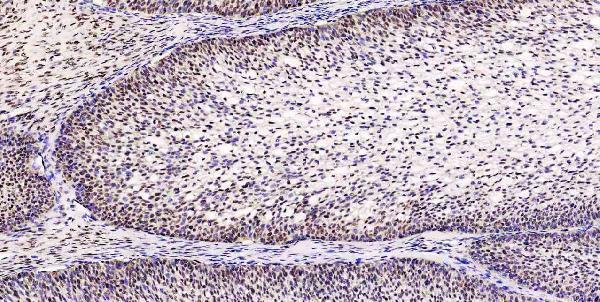 a05052 1 msi1 primary antibodies ihc testing 14