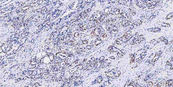 a05052 1 msi1 primary antibodies ihc testing 15
