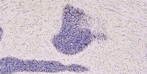 a05052 1 msi1 primary antibodies ihc testing 17