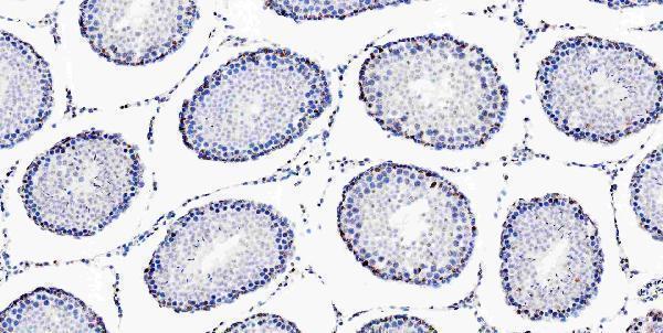 a05052 1 msi1 primary antibodies ihc testing 19