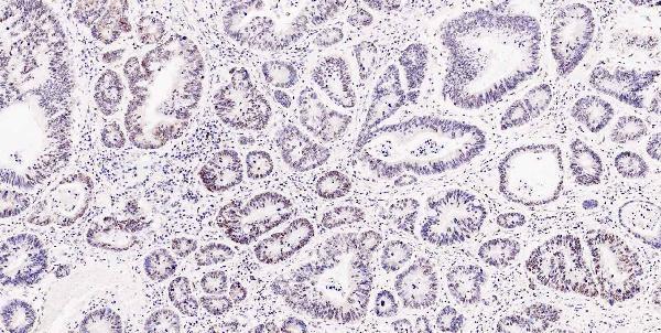 a05052 1 msi1 primary antibodies ihc testing 20