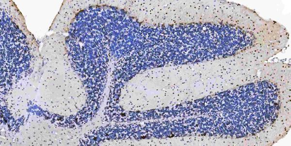a05052 1 msi1 primary antibodies ihc testing 8