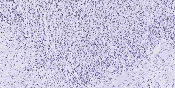 a05052 1 msi1 primary antibodies ihc testing 9