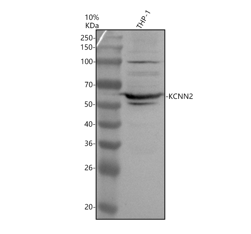 Western blot analysis of KCNN2 using anti-KCNN2 antibody (A05055-1)