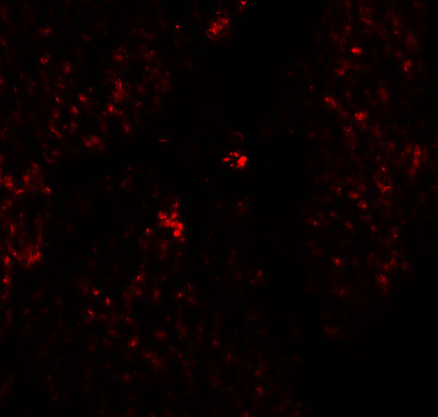 a05056 hmmr primary antibodies if testing 4