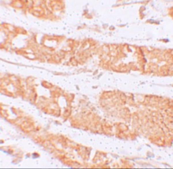 Immunohistochemistry of RHAMM in human stomach tissue with RHAMM antibody at 2