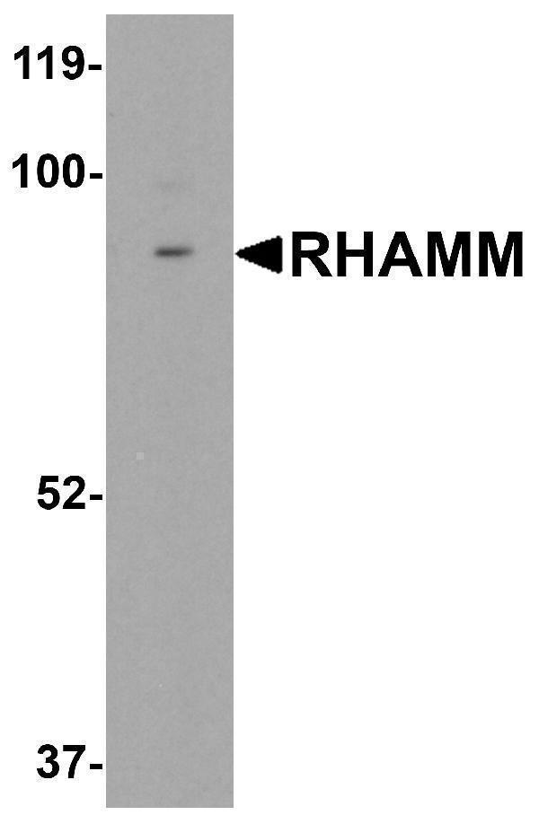 Western blot analysis of RHAMM in rat stomach tissue lysate with RHAMM antibody at 0