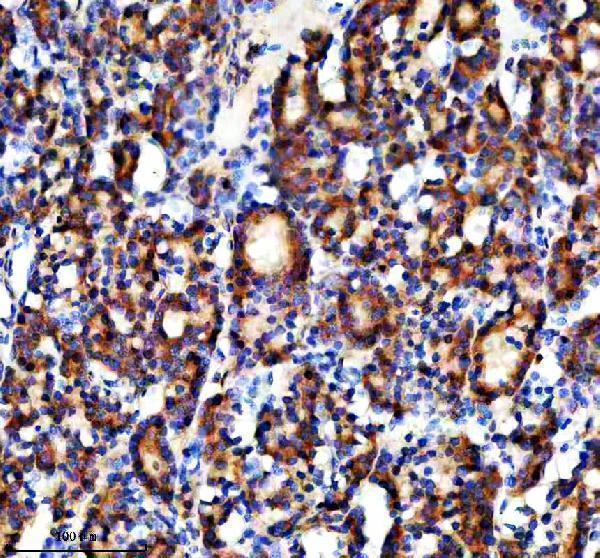  IHC analysis of NAGK using anti-NAGK antibody (A05057-1)