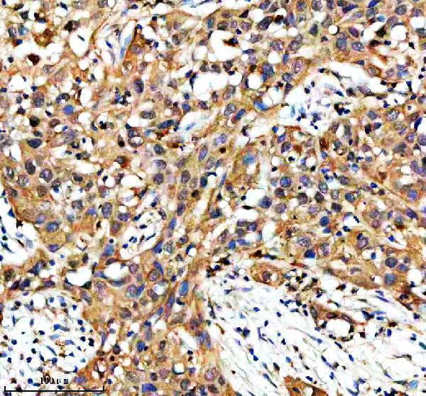  IHC analysis of NAGK using anti-NAGK antibody (A05057-1)