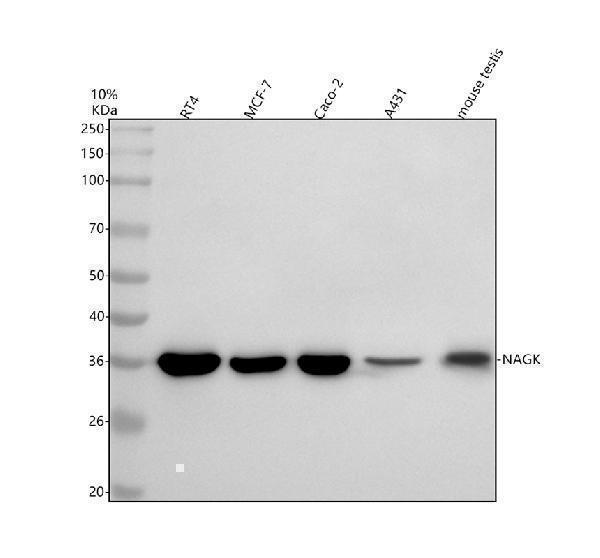  Western blot analysis of NAGK using anti-NAGK antibody (A05057-1)