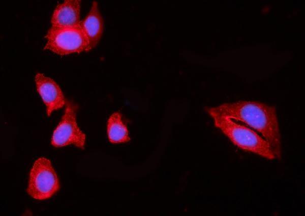 a05059 2 hip1r primary antibodies if testing 6
