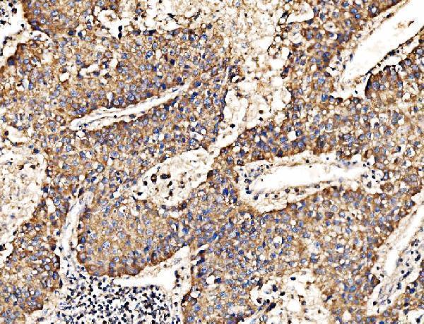  IHC analysis of HIP1R using anti-HIP1R antibody (A05059-2)