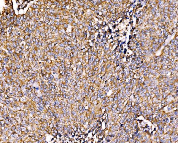  IHC analysis of HIP1R using anti-HIP1R antibody (A05059-2)