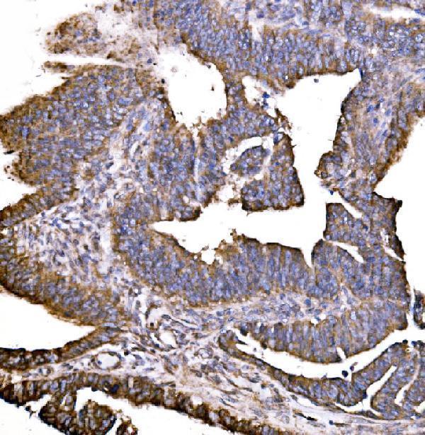 a05059 2 hip1r primary antibodies ihc testing 4