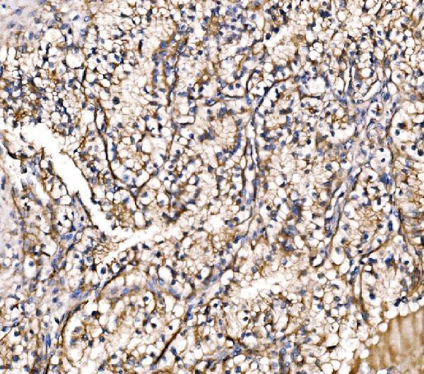 a05059 2 hip1r primary antibodies ihc testing 5