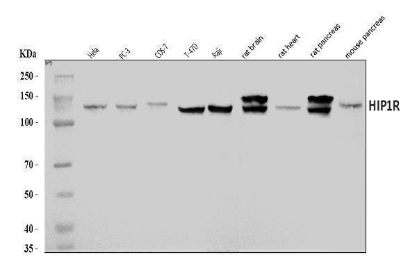  Western blot analysis of HIP1R using anti-HIP1R antibody (A05059-2)