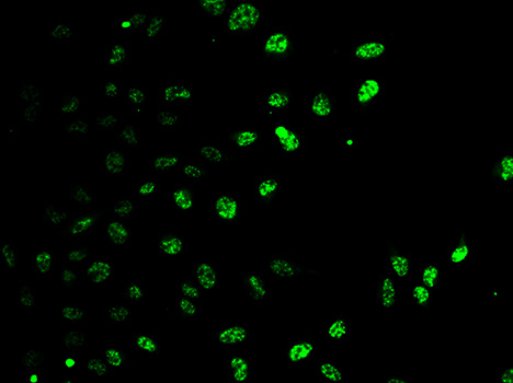 a05062 e2f6 primary antiboties if testing 2