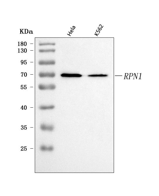  Western blot analysis of Ribophorin I/RPN1 using anti-Ribophorin I/RPN1 antibody (A05063-1)