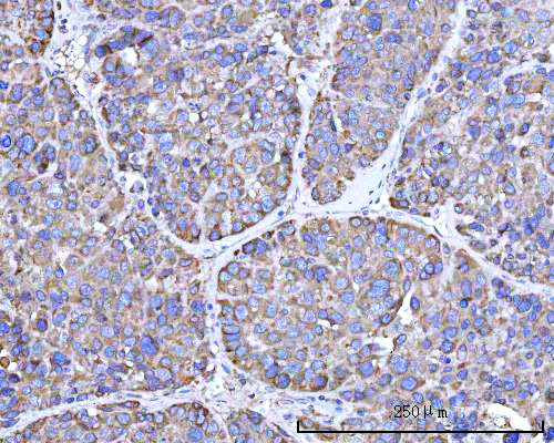  IHC analysis of RPN1 using anti-RPN1 antibody (A05063-2)