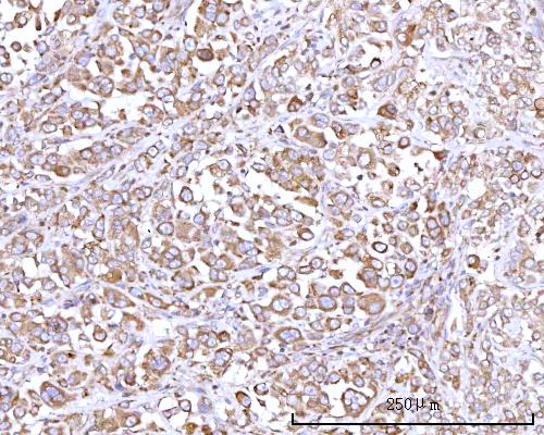  IHC analysis of RPN1 using anti-RPN1 antibody (A05063-2)