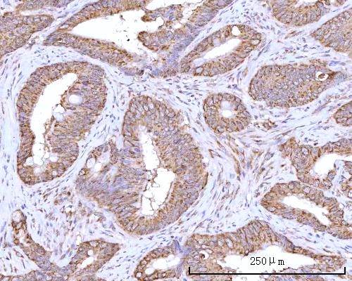 a05063 2 rpn1 primary antibodies ihc testing 5