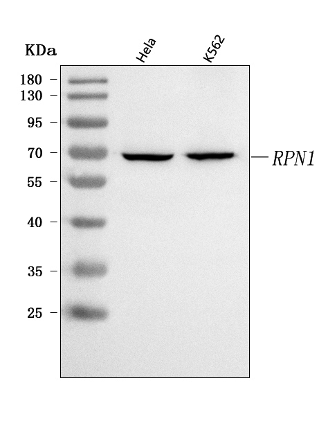  Western blot analysis of RPN1 using anti-RPN1 antibody (A05063-2)