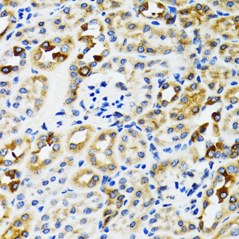 a05063 rpn1 primary antiboties ihc testing 2