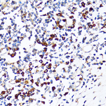 a05063 rpn1 primary antiboties ihc testing 3