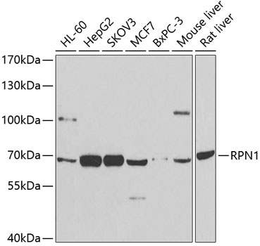 a05063 rpn1 primary antiboties wb testing 1