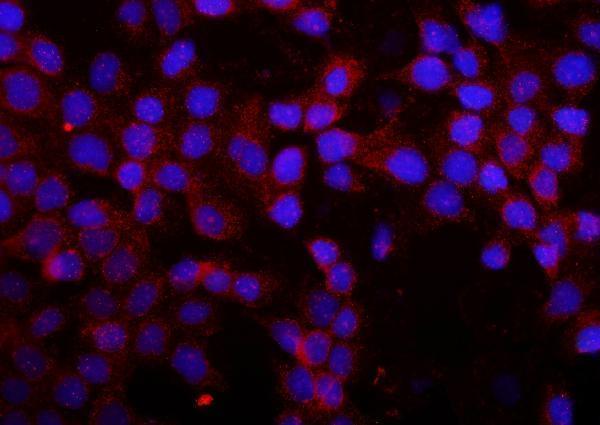 a05065 mmp16 primary antibodies if testing 6