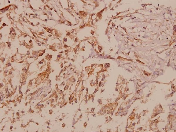 a05065t583 mmp16 primary antiboties ihc testing 2