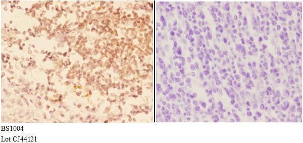 a05066 1 actg2 primary antiboties ihc testing 3
