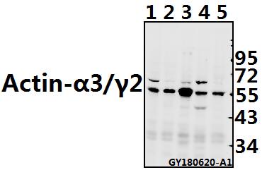 a05066 1 actg2 primary antiboties wb testing 1