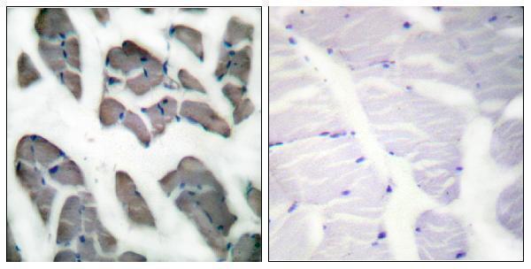 a05066 actg2 primary antibodies ihc testing 1