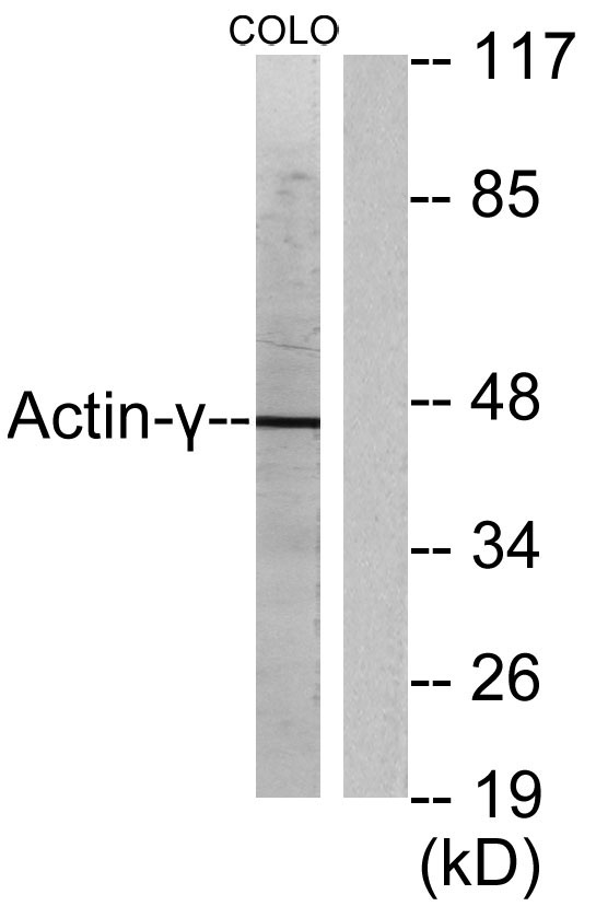 a05066 actg2 primary antibodies wb testing 4