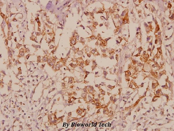 a05068 1 mapk8ip1 primary antiboties ihc testing 2