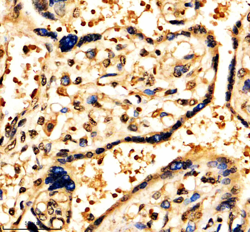 a05068 2 mapk8ip1 primary antibodies ihc testing 1