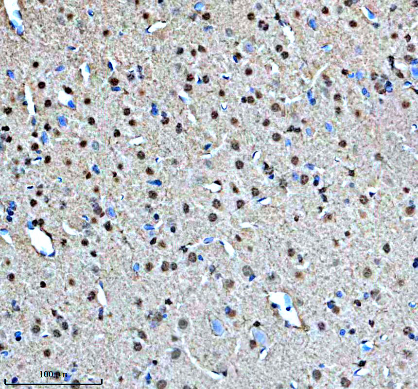 a05068 2 mapk8ip1 primary antibodies ihc testing 2