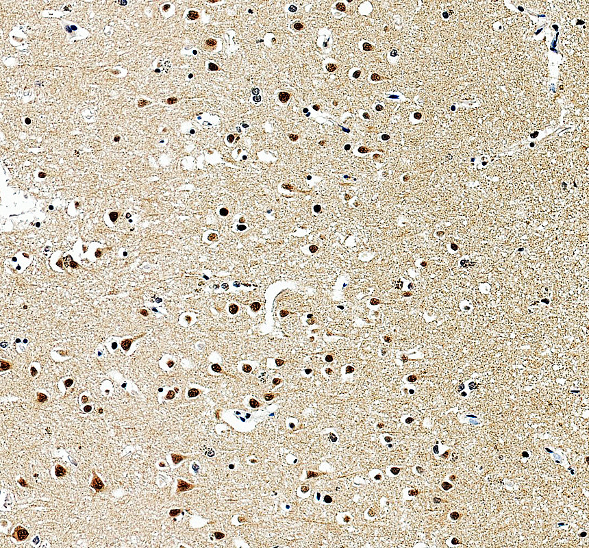 a05068 2 mapk8ip1 primary antibodies ihc testing 4