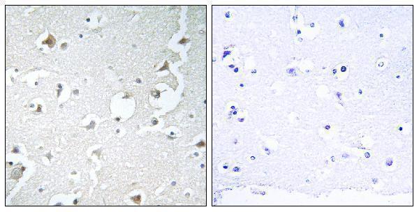 a05068 mapk8ip1 primary antibodies ihc testing 4