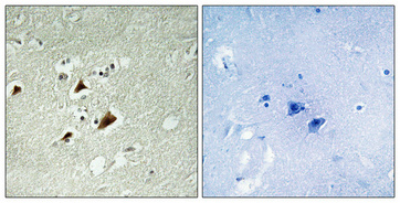 a05068t103 mapk8ip1 primary antibodyes ihc testing 2