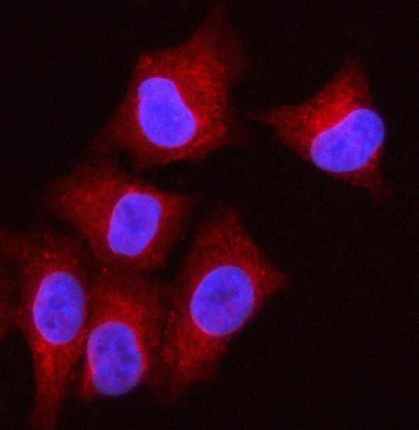 IF analysis of OLAH using anti-OLAH antibody (A05069-3)
