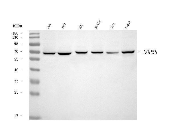  Western blot analysis of NOP58 using anti-NOP58 antibody (A05070-1)