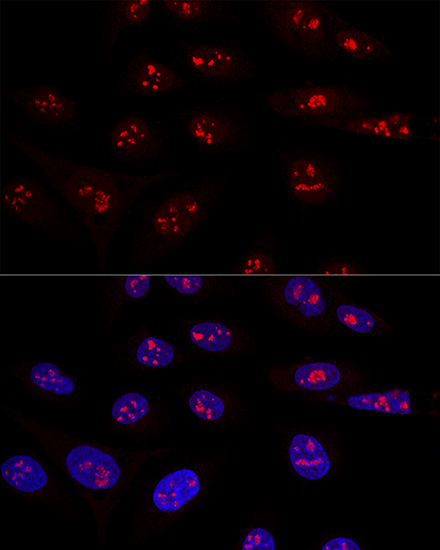 a05070 nop58 primary antiboties if testing 2