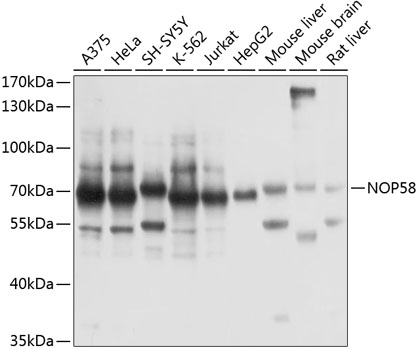a05070 nop58 primary antiboties wb testing 1
