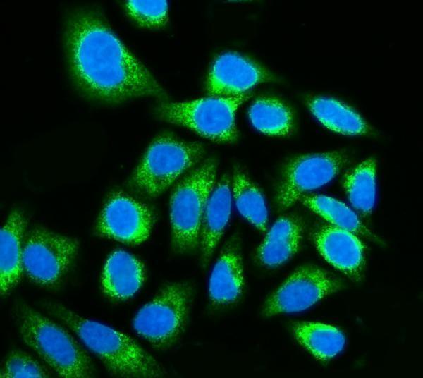 a05071 1 ktn1 primary antibodies if testing 7