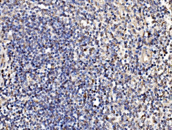  IHC analysis of Kinectin 1/KTN1 using anti-Kinectin 1/KTN1 antibody (A05071-1)