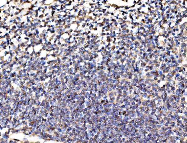  IHC analysis of Kinectin 1/KTN1 using anti-Kinectin 1/KTN1 antibody (A05071-1)